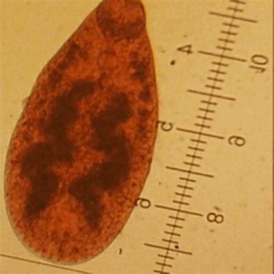  Xiphidiocercaria!  One Trematode Parasite You Never Knew Existed